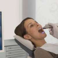 Cerec 3D AC